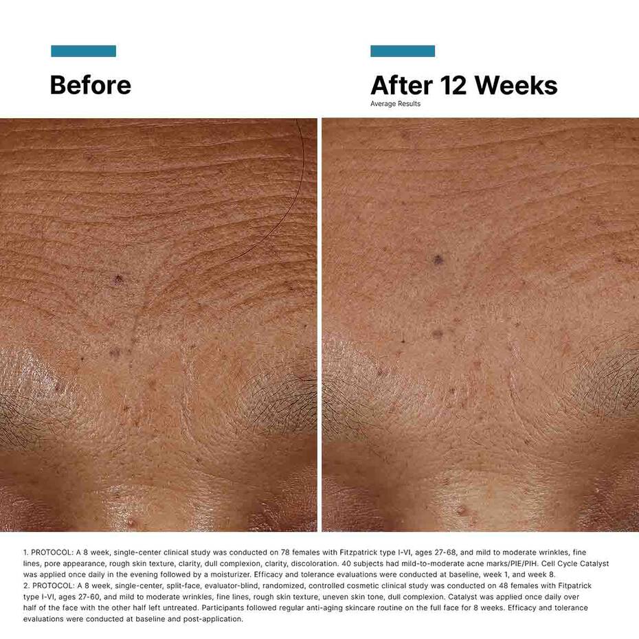 Hyaluronic Acid Intensifier Multi-Glycan