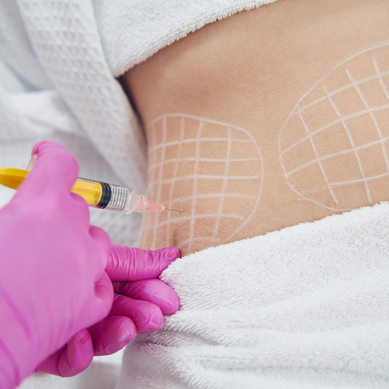 Fat Dissolve Injection