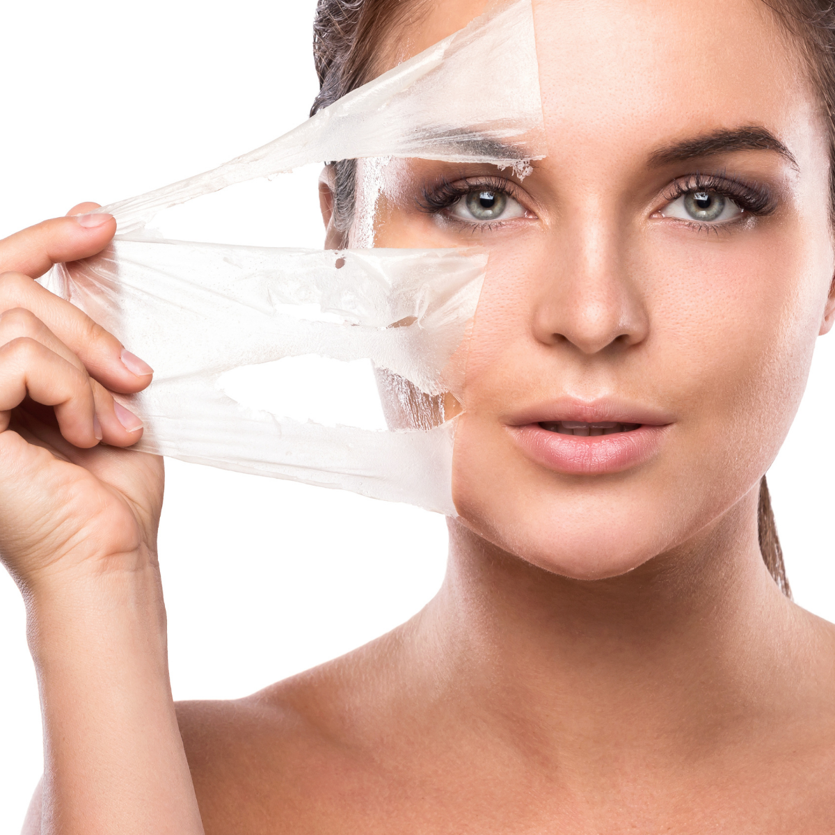 TCA Chemical Peel