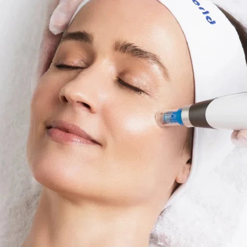 DP4 Microneedling