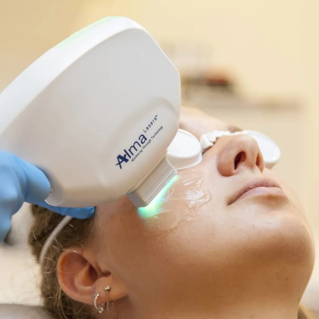 Alma® IPL
